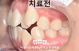 수술전