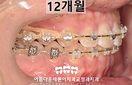 수술후