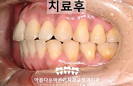 수술후