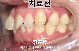수술전