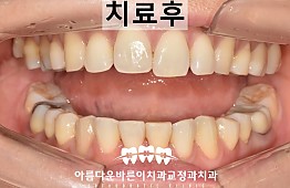 수술후