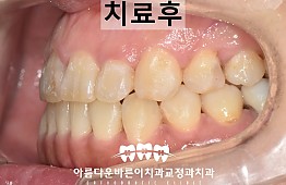 수술후