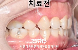 수술전