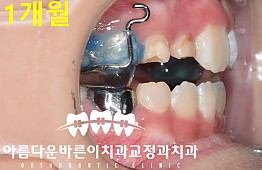 수술후