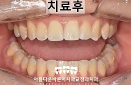 수술후