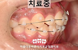 수술후