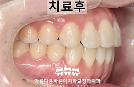 수술후