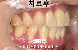 수술후