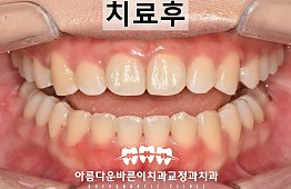 수술후