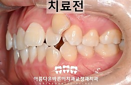 수술전