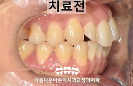 수술전