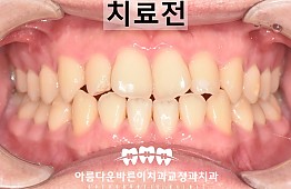 수술전