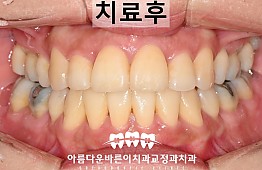 수술후