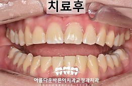 수술후