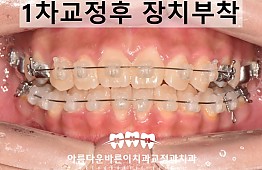 수술후