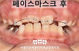 수술후