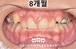 수술후